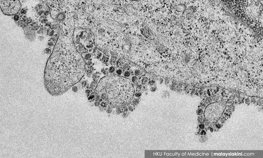 Covid-19 – Deadly coronavirus disease gets official name