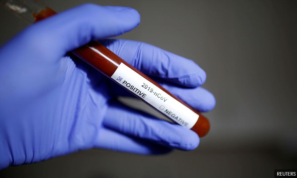 Health DG explains why reported Covid-19 tests appear below capacity