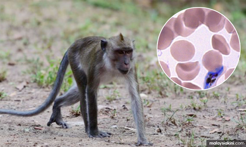 Kelantan catat 65 kes malaria monyet antara Jan - Ogos