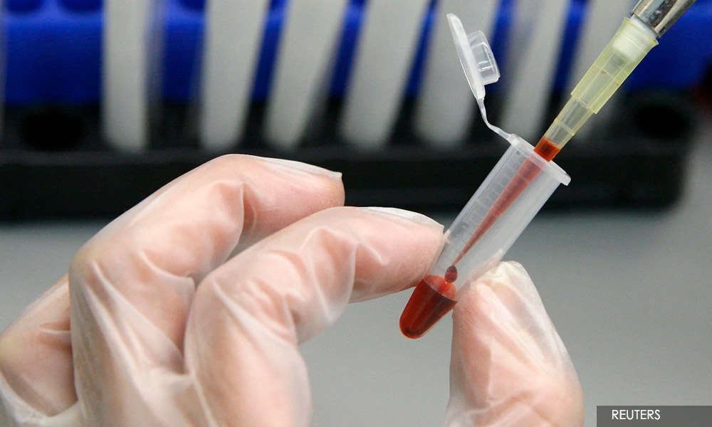 LETTER | Nutrition and HIV