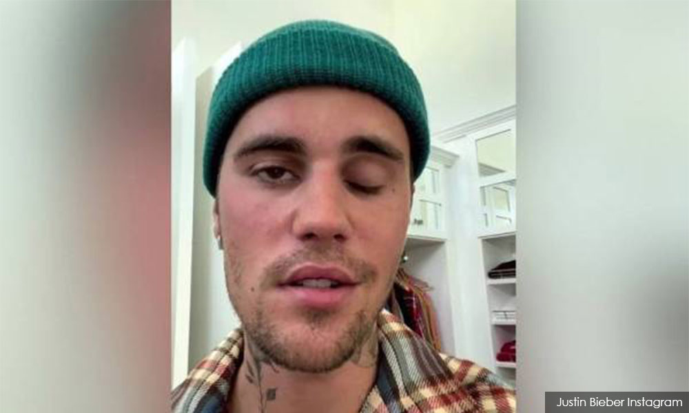 Justin Bieber diserang sindrom Ramsay Hunt