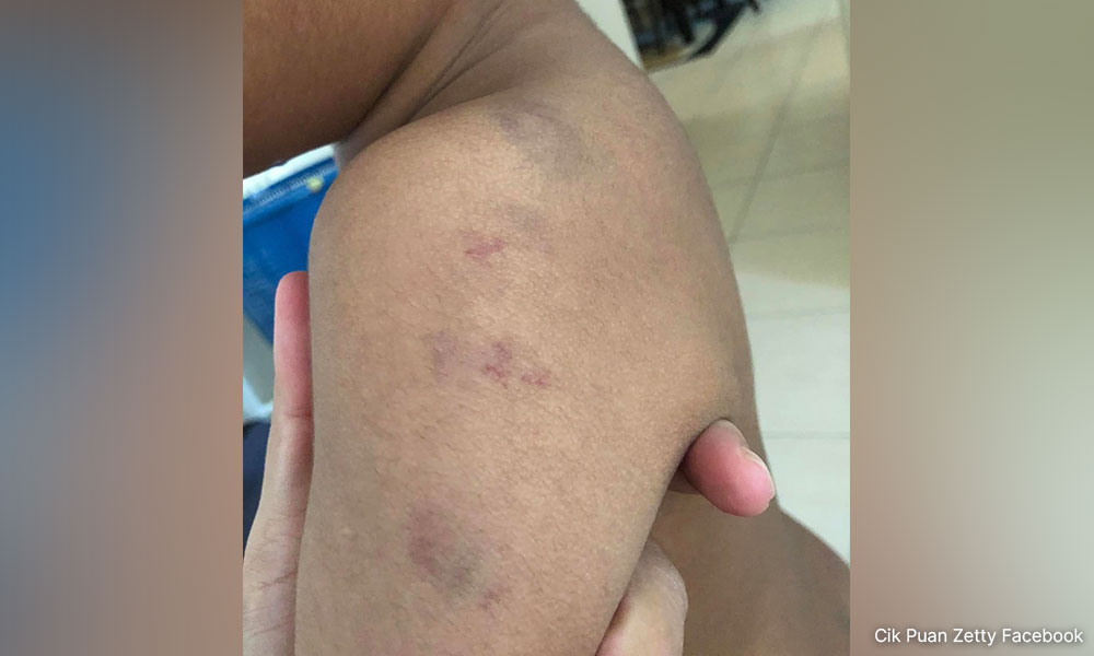 Polis siasat dakwaan anak autisme didera guru pusat terapi