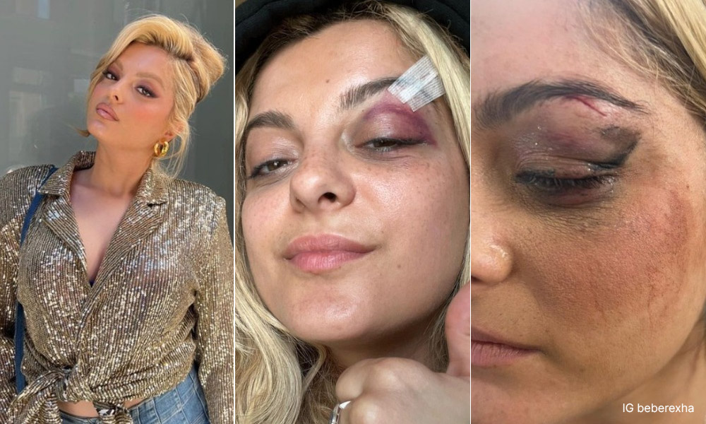 Penyerang anggap lempar telefon ke Bebe Rexha aksi kelakar
