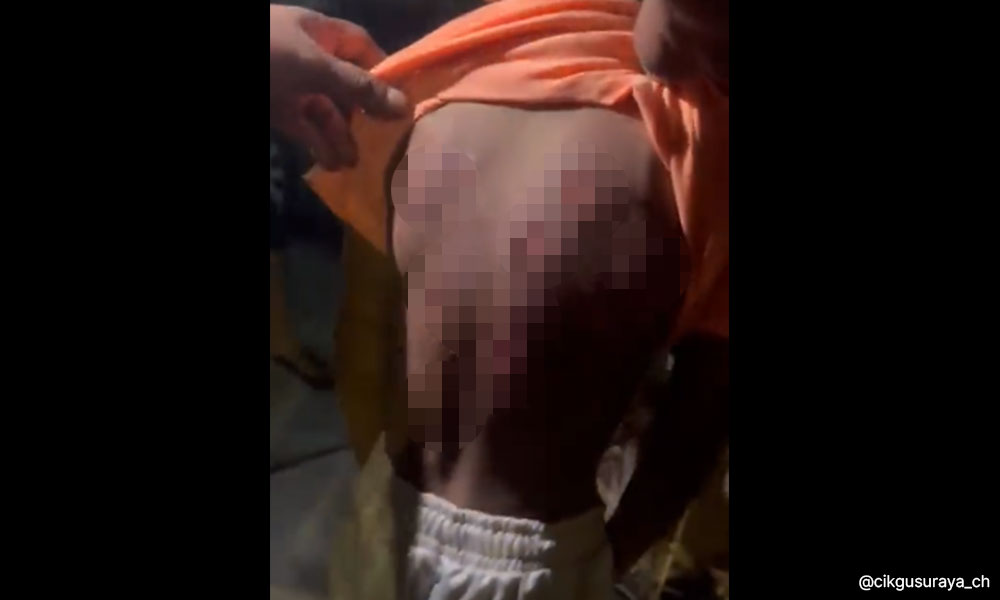 Mother, female friend arrested over alleged abuse of 7-year-old boy