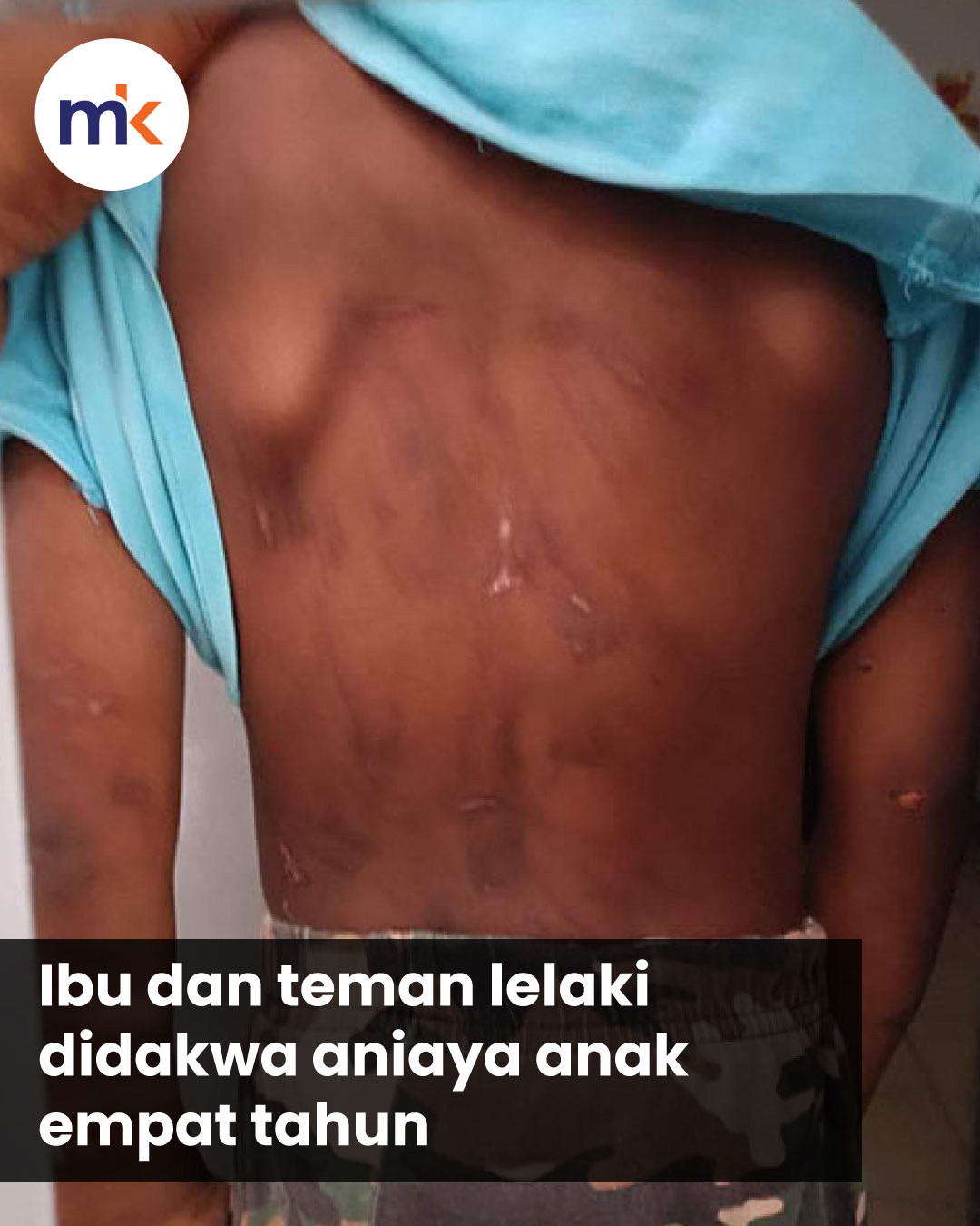 Ibu dan teman lelaki didakwa aniaya anak empat tahun