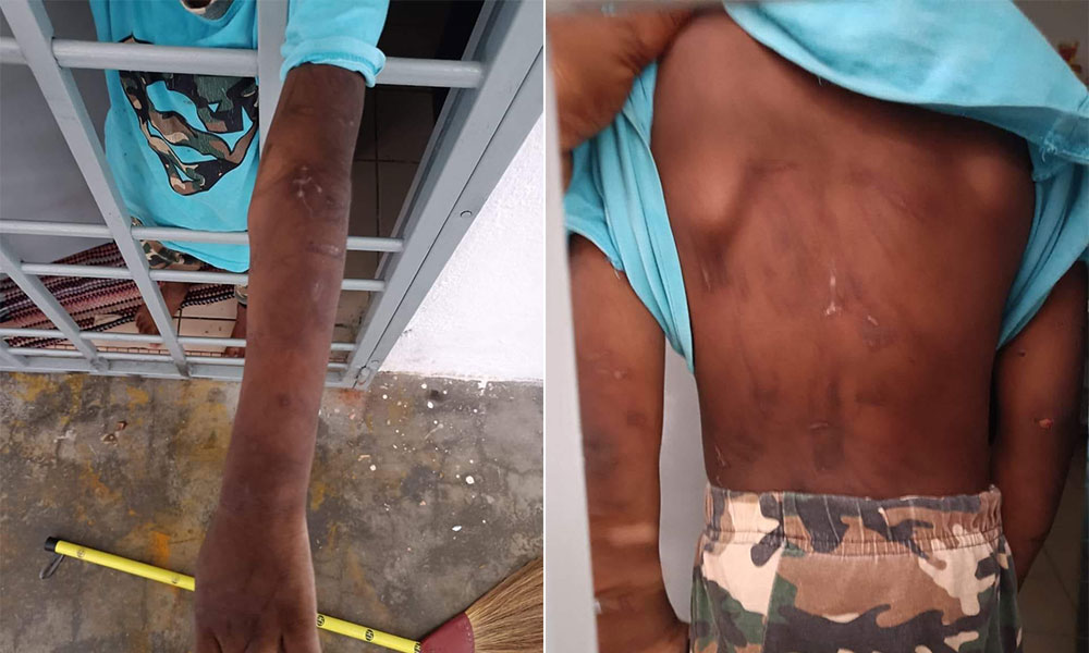 Four-year-old's cry for food leads to discovery of abuse