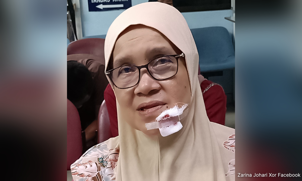 Endau rep injured in road accident
