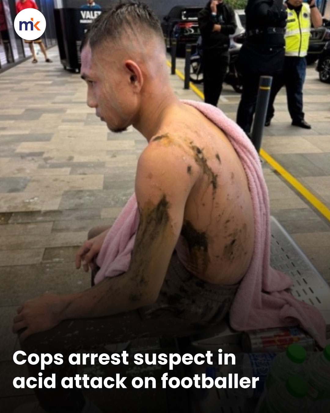 Cops arrest suspect in acid attack on footballer