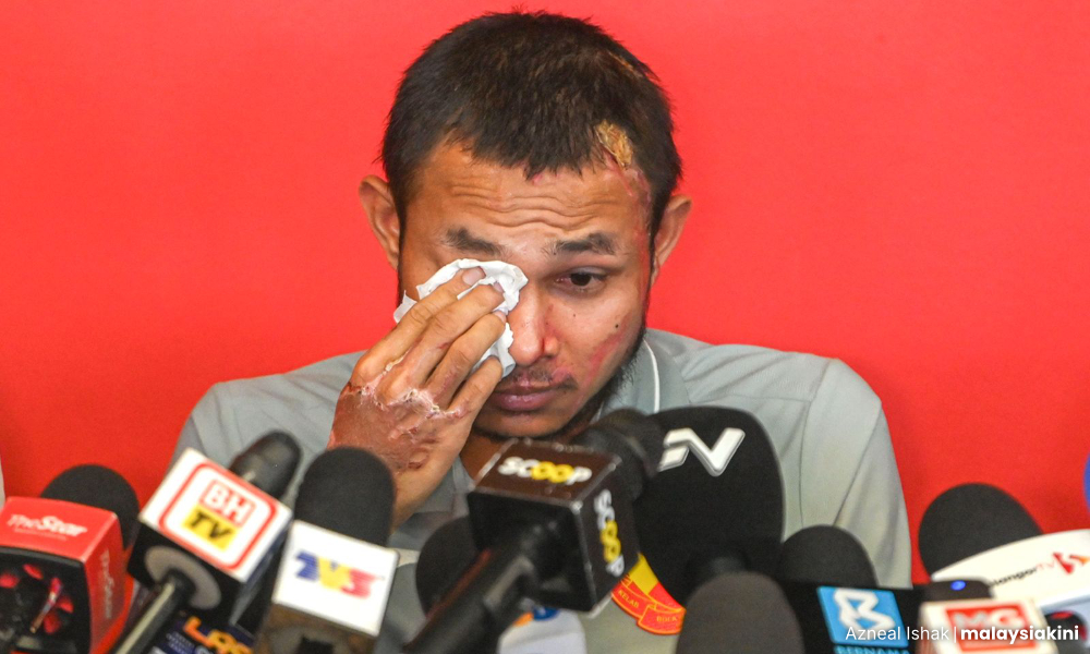 Kes simbah asid Faisal Halim diklasifikasi 'tiada tindakan lanjut'