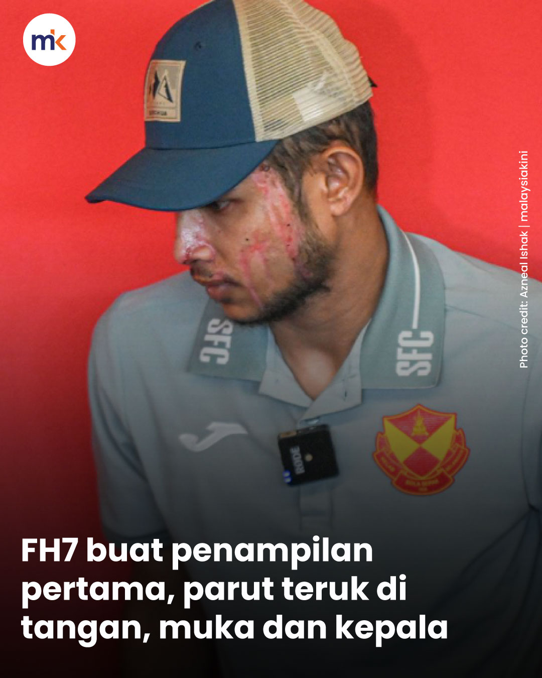 FH7 buat penampilan pertama, parut teruk di tangan, muka dan kepala