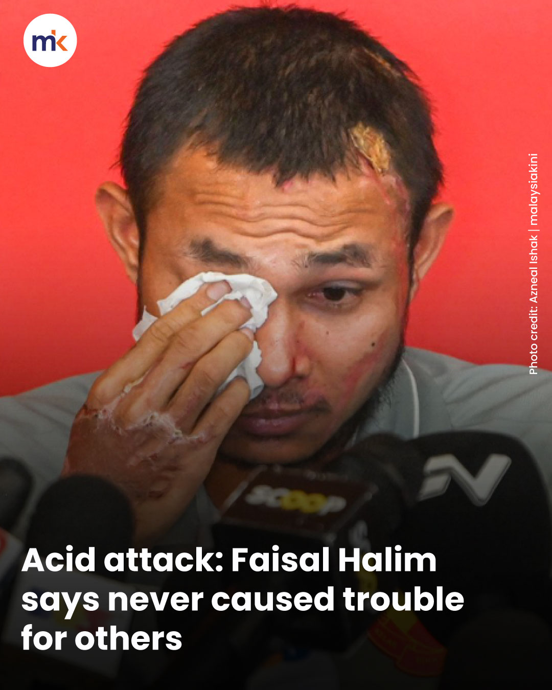 Acid attack: Faisal Halim says never caused trouble for others