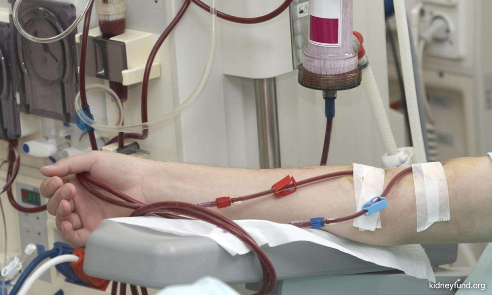 LETTER | Exploring single-use, multi-use dialysers for patient well-being