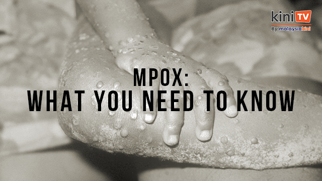 [Explainer] Mpox in Malaysia: What You Need to Know