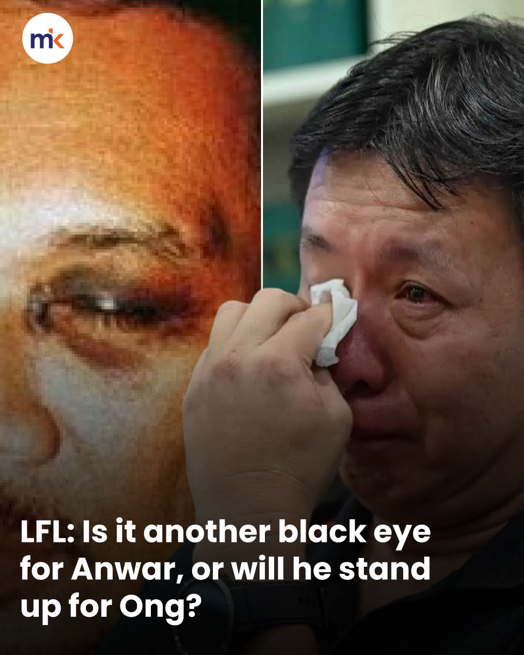 LFL: Is it another black eye for Anwar, or will he stand up for Ong?