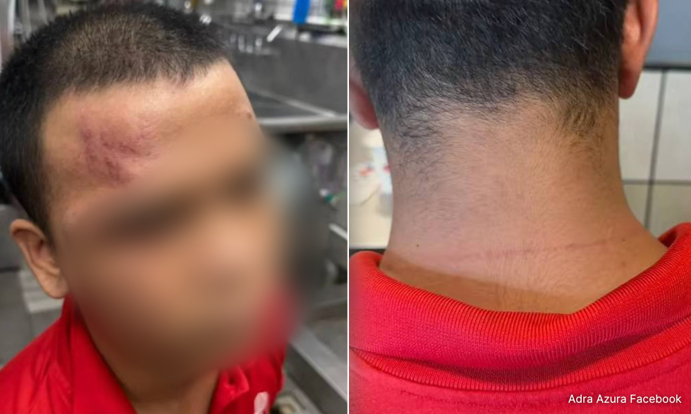 Mum claims cop told her to drop report after autistic son beaten at work