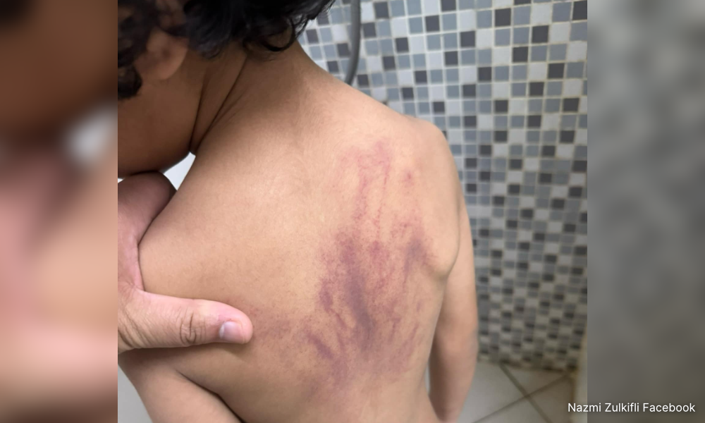 Lack of evidence: Police confirm NFA on autistic boy's alleged abuse case