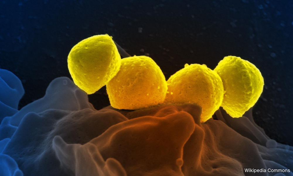 M'sia free of streptococcus suis infections linked to pigs: DVS
