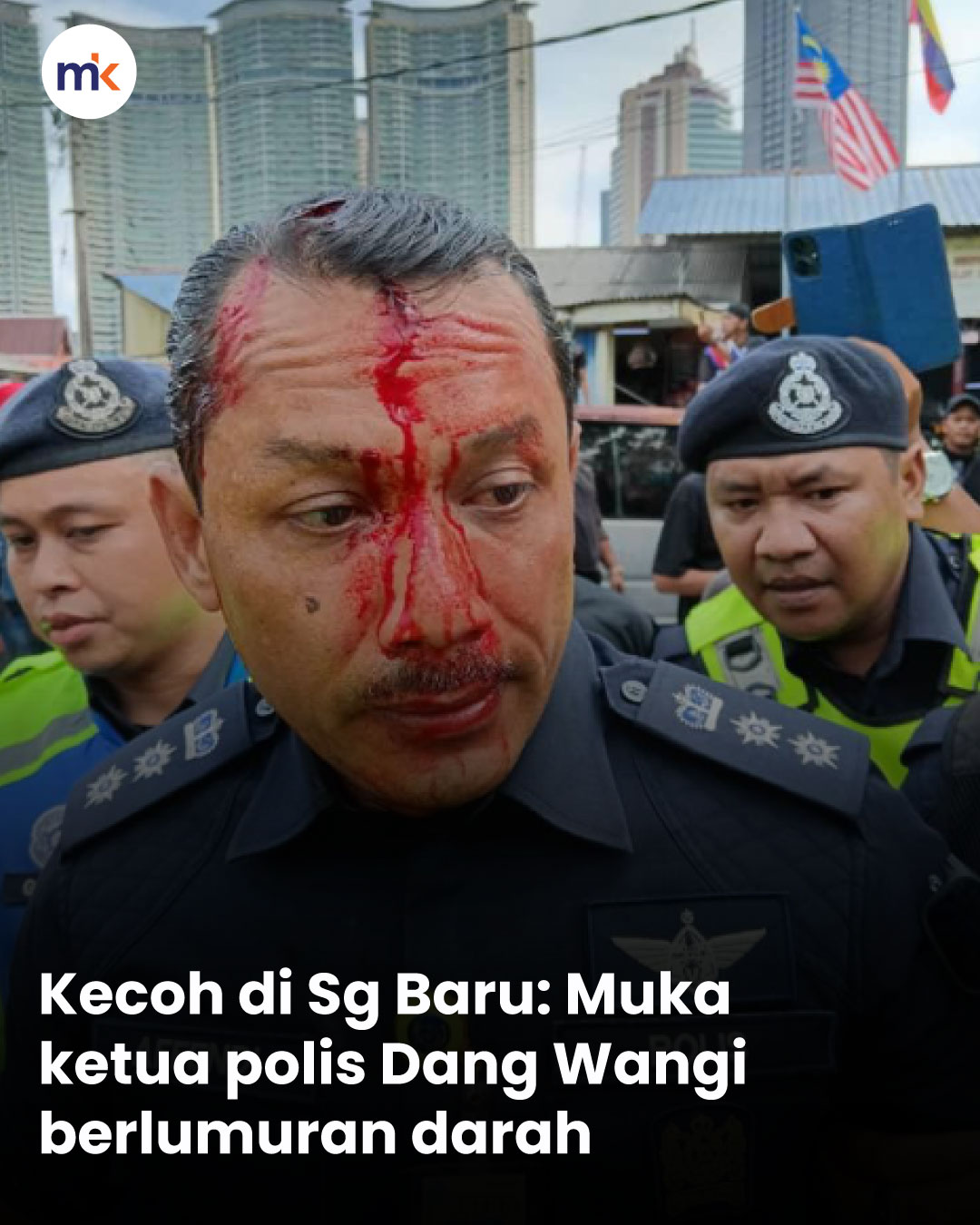 Kecoh di Sg Baru: Muka ketua polis Dang Wangi berlumuran darah