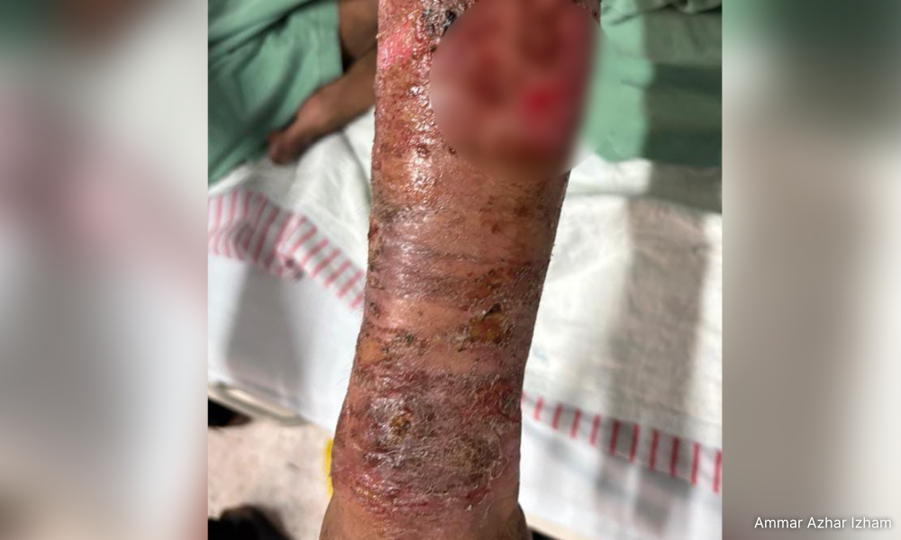 039510f384b574a0f66b78e021337be6