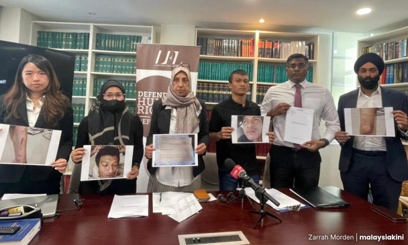 'Polis ambil lighter, hulur api dekat kemaluan saya'