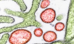 印度西孟邦爆立百疫情，大马政府加强国际入境筛查