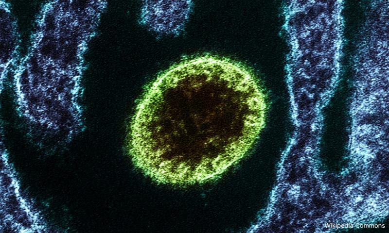 Singapura pantau rapi situasi virus Nipah, tiada kes dikesan setakat ini