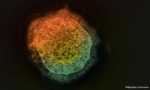 KINIGUIDE | What M'sians need to know about Nipah virus